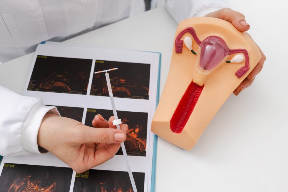 Experienced gynecologist showing female patient intrauterine contraceptive device or coil to